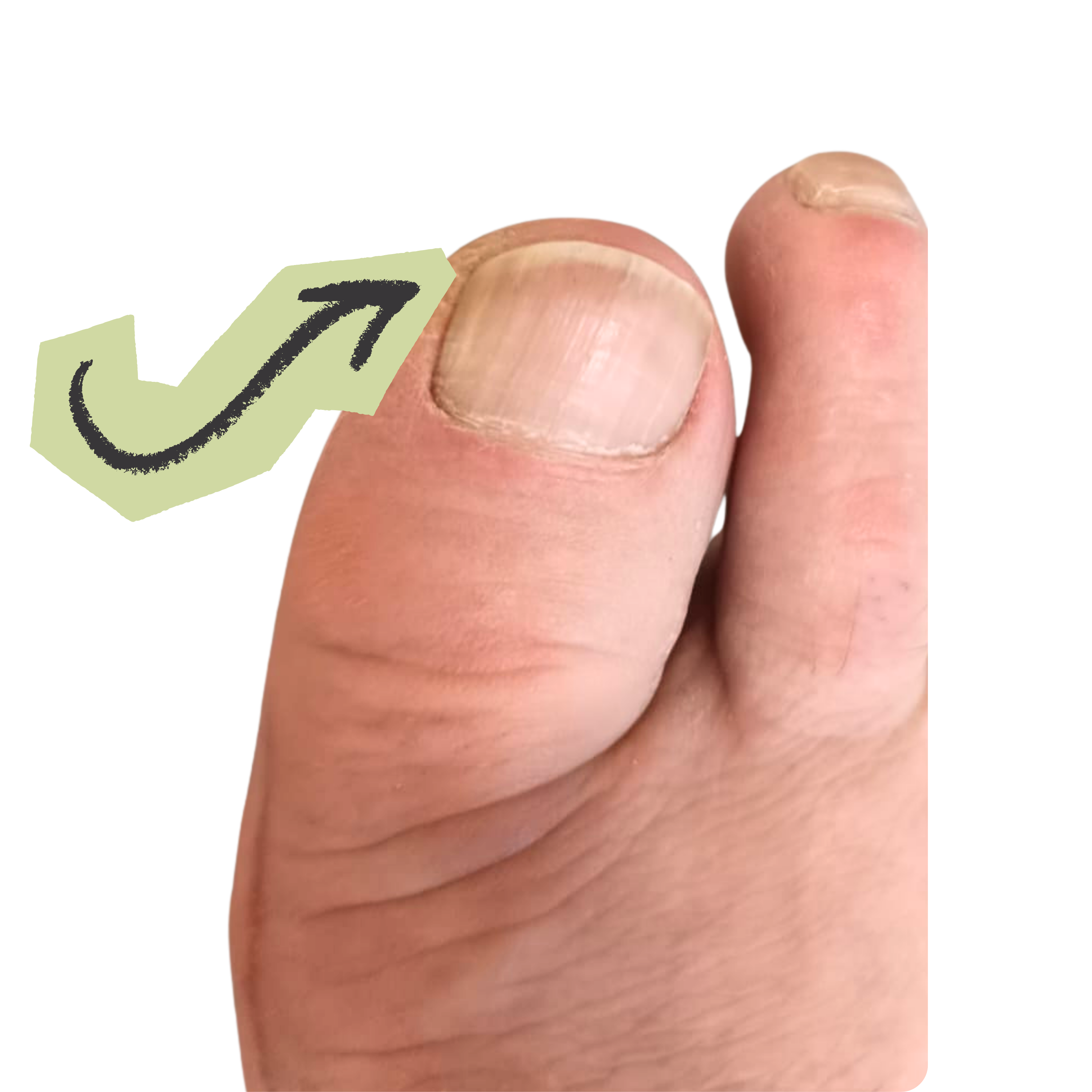 Nehet po použití VitaNail