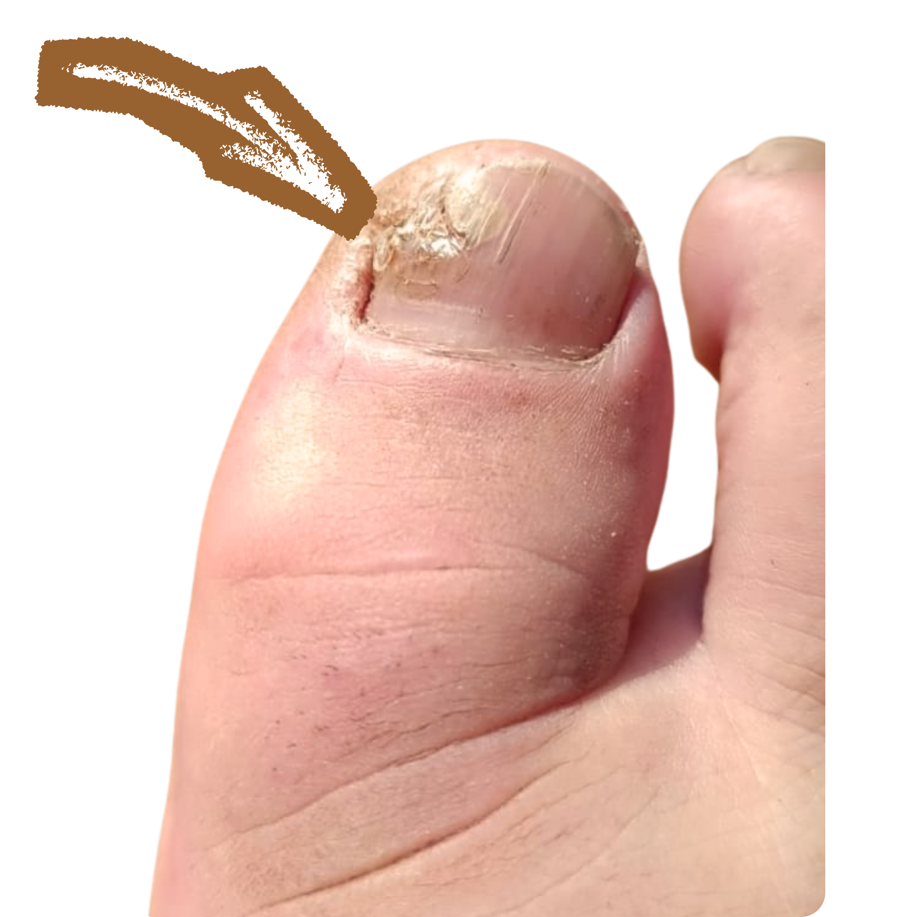 Nehet před použitím VitaNail