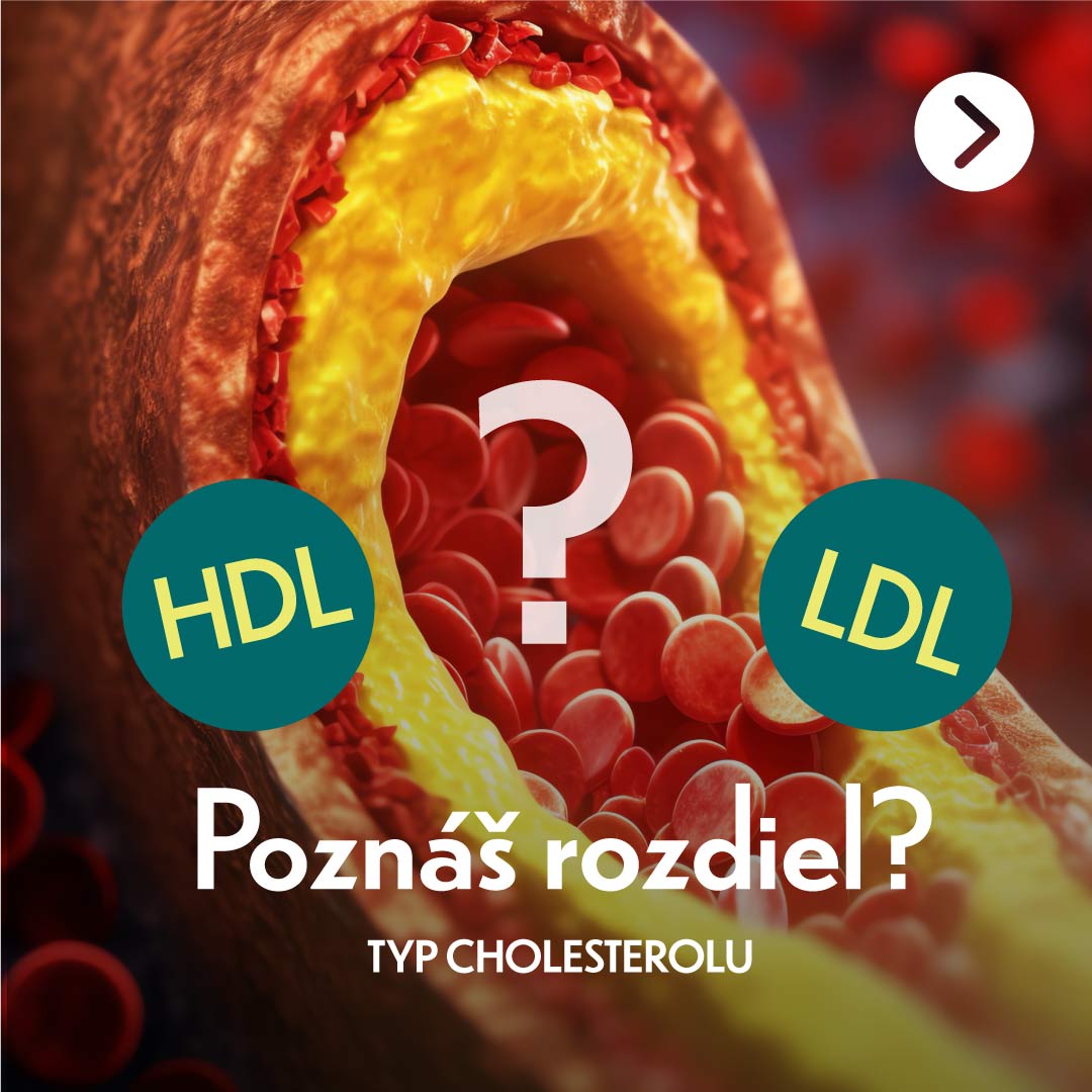 Rozdiel medzi HDL a LDL cholesterolom