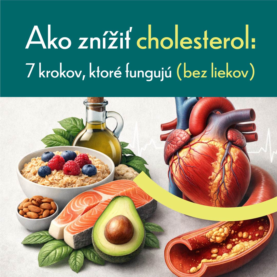 Ako znížiť cholesterol: 7 krokov, ktoré fungujú (bez liekov)