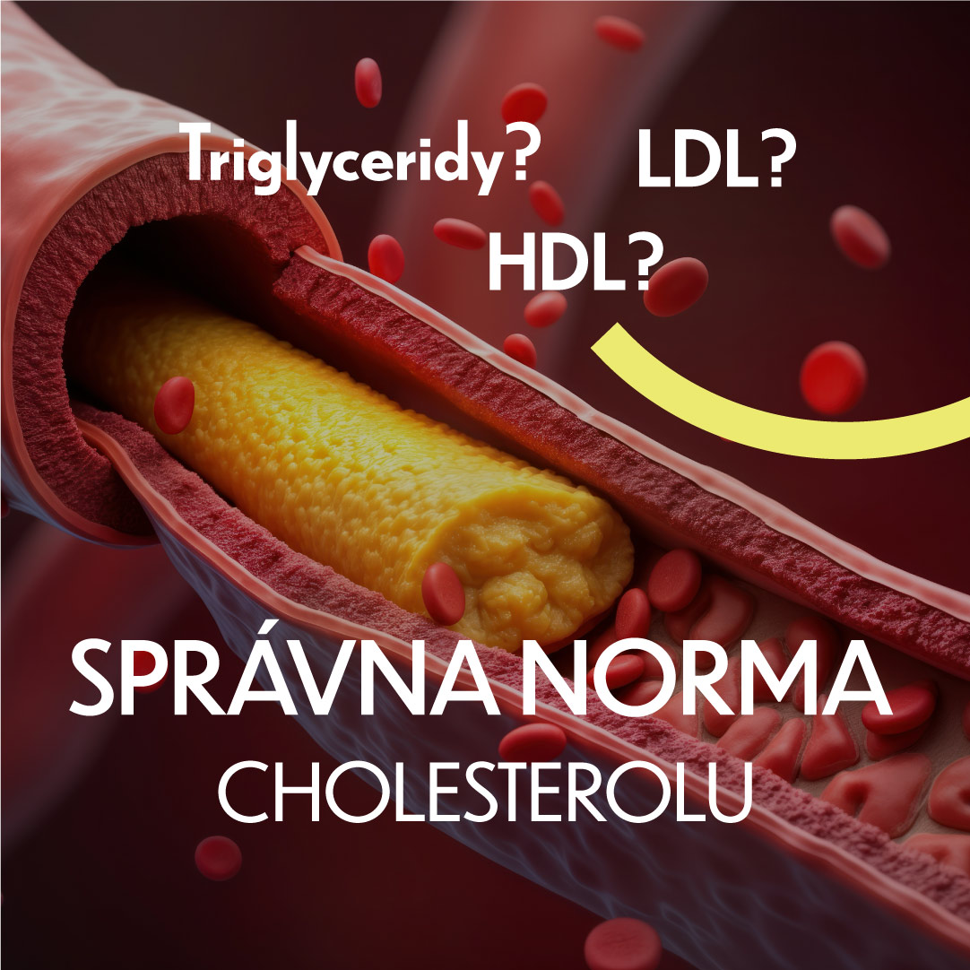 Cholesterol norma: Aká je dobrá a aká je zlá hodnota?