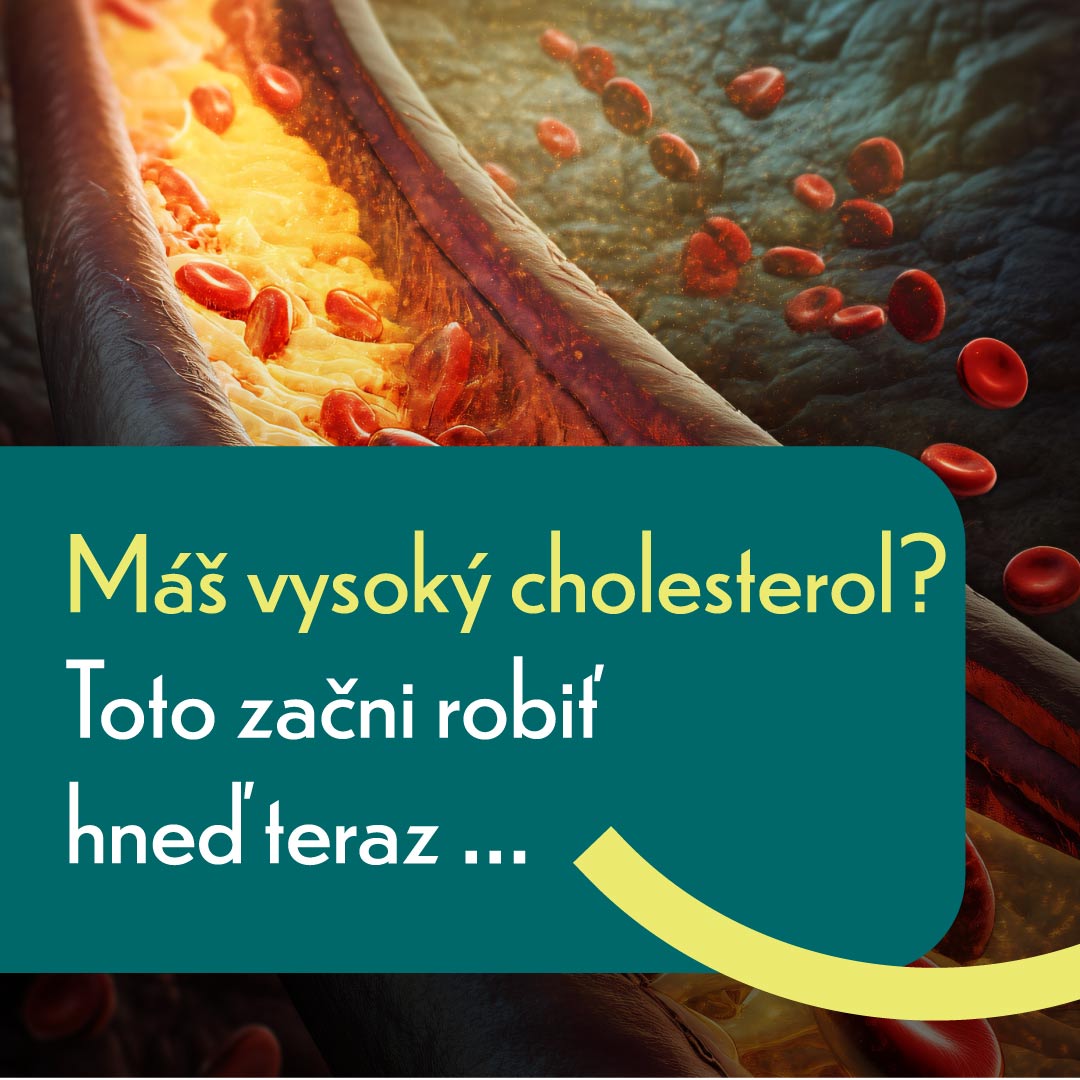 Čo robiť hneď teraz, ak máte vysoký cholesterol?