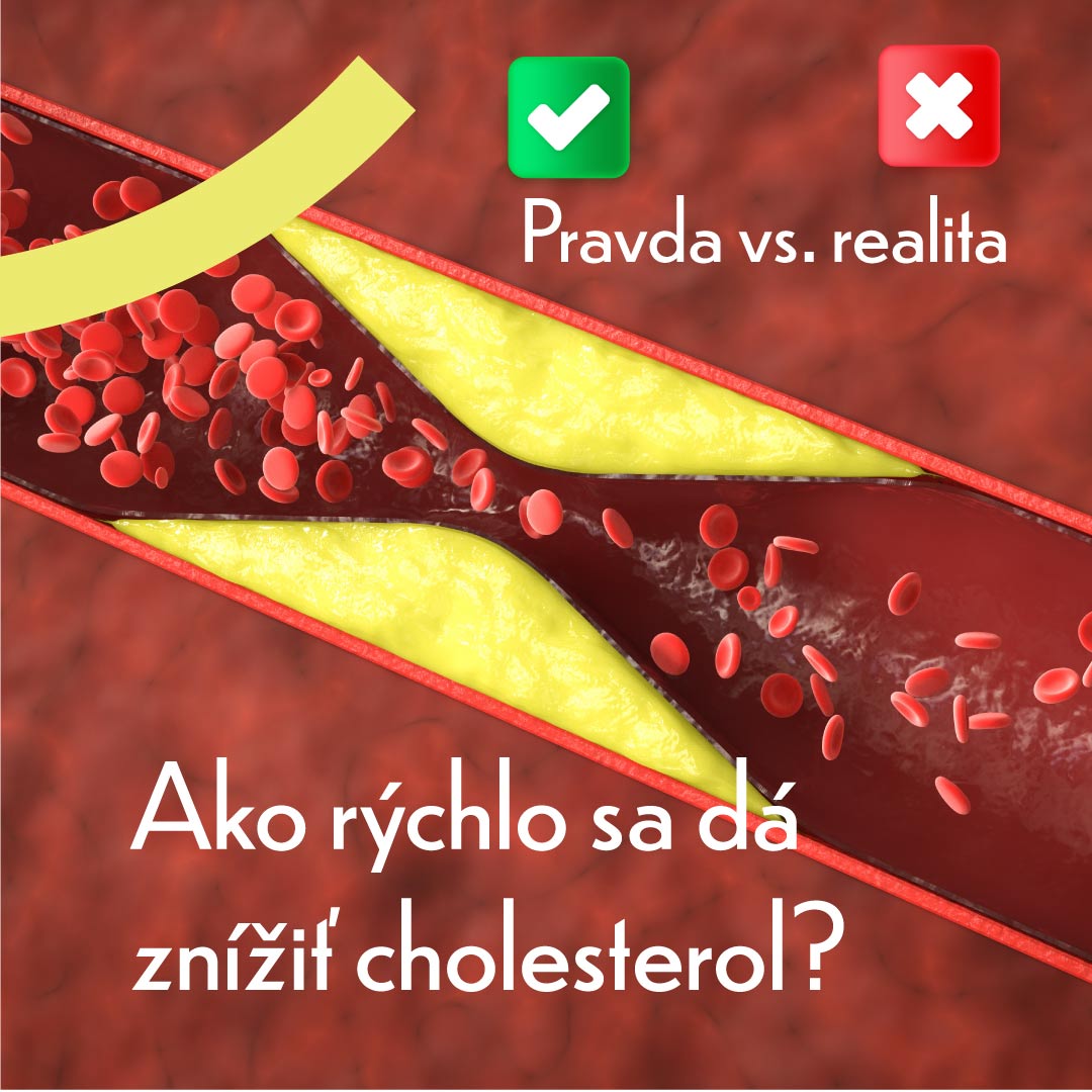 ako-rýchlo-sa-dá-znížiť-cholesterol--Tipy-od-VitaOuk