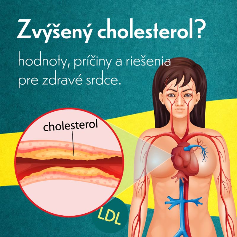 zvýšený-cholesterol--Hodnoty,-riešenia,-pričiny