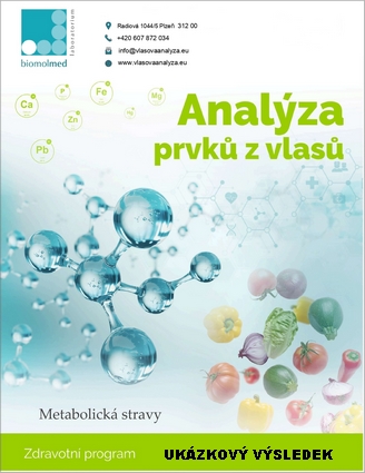 UkazkaVL_Met