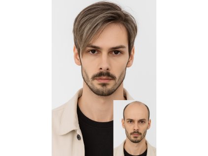 vlasový systém, tupé, pánská paruka, integrace natur hair