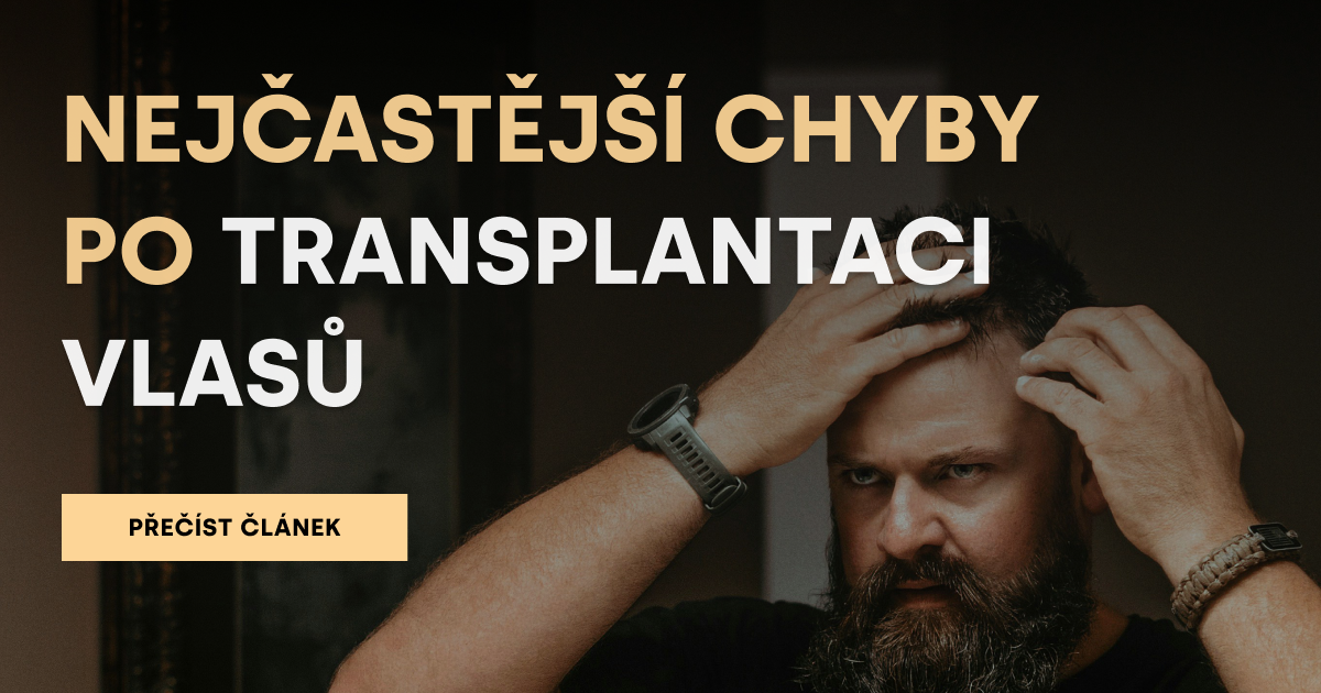 Nejčastější chyby po transplantaci vlasů
