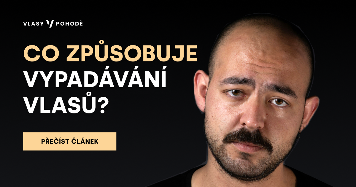 Co způsobuje vypadávání vlasů? Nejen genetika, ale i hormony, stres a špatná výživa