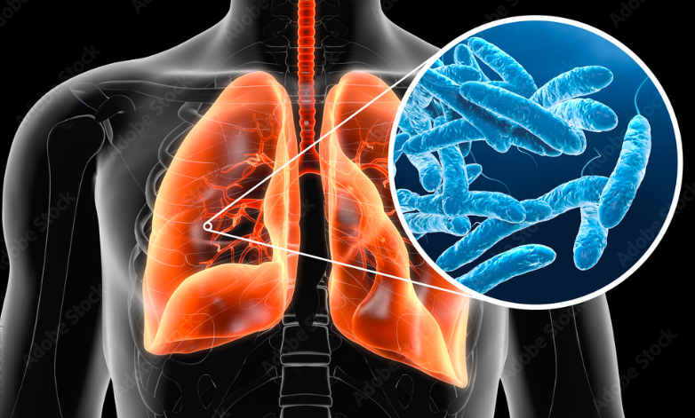 Nebezpečná legionella vo vode a prevencia - ako ochrániť domov?