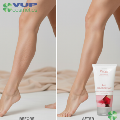 ACG Gél s čili: Funguje tento hrejivý gél proti celulitíde?