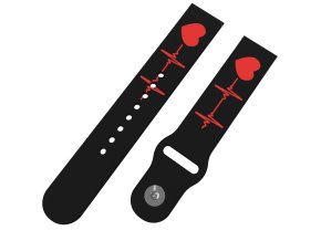 16131 3 ekg reminek 20 mm0071 k54 blk a