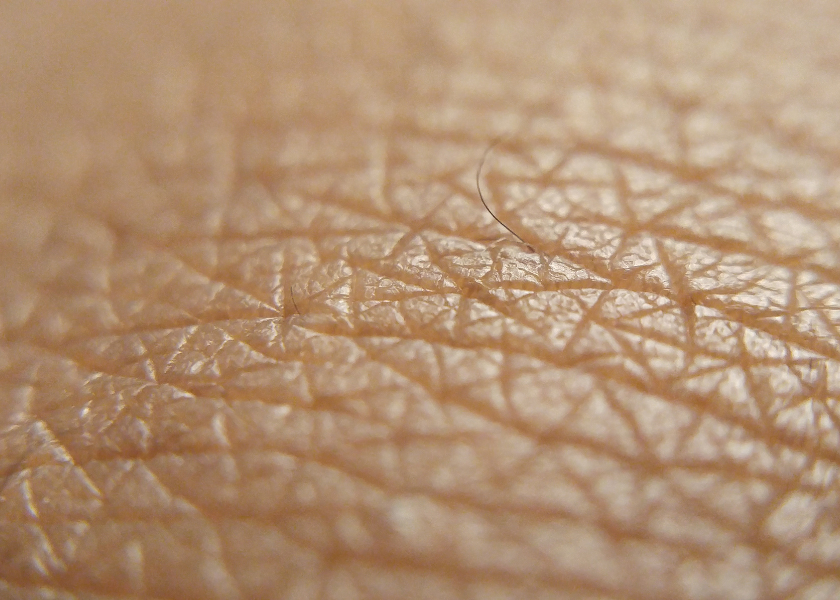 Detail_pokozky