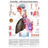 Dýchacia sústava - anatomický plagát