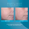 beauty focus collagen plus lumispa before after 3 600x600 bc87582 kopie