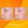 beauty focus collagen plus only before after 1 600x600 bc87582