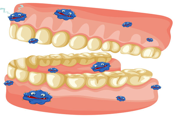 Odhalte pravdu o ústním mikrobiomu a zubním plaku