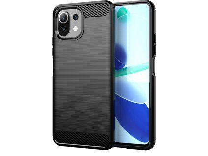 Carbon Case for Xiaomi Mi 11 Lite 4G/5G/11 Lite 5G NE - Black