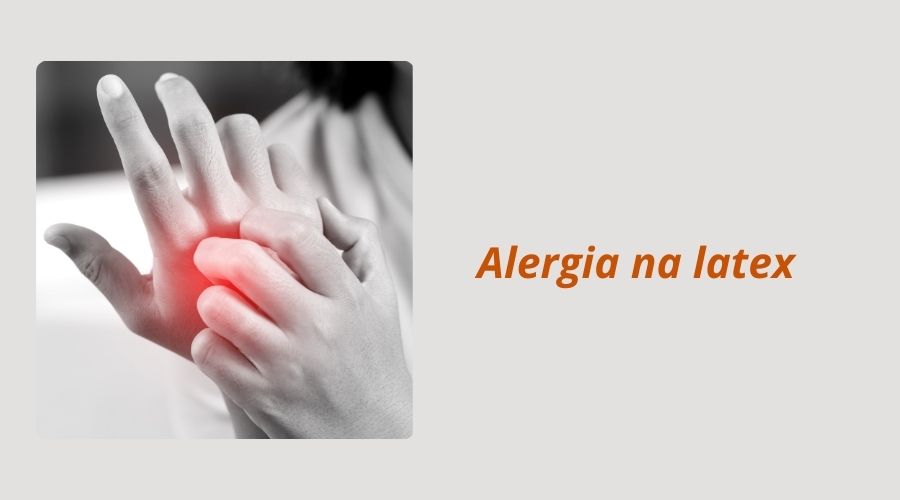 Alergia-na-latex