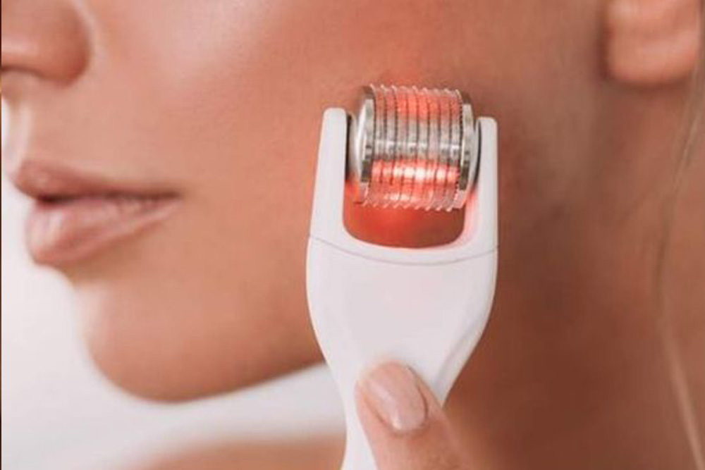 Microneedleing