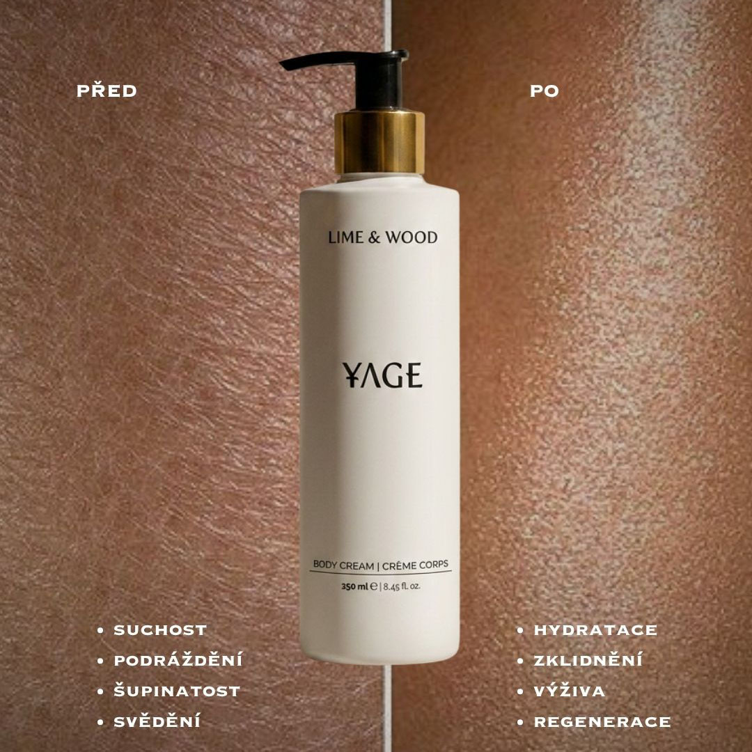 REGENERACE