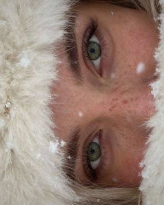 Pokud trpíte na rosaceu, možná pozorujete v zimních měsících zhoršení projevů. V novém článku na blogu se věnujeme zimní...