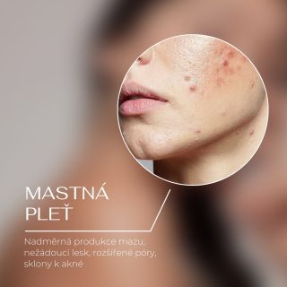 Mastná pleť může být náročná, ale se správnou péčí se dá snadno zkrotit! ✨ Pokud vás trápí nadměrná produkce mazu, lesklá...