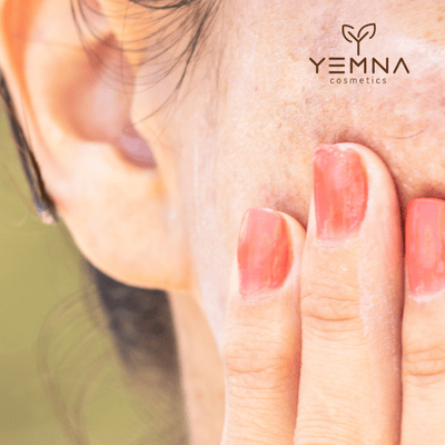 Prečo funguje kyselina tranexámová a vitamín C v starostlivosti o pigmentáciu