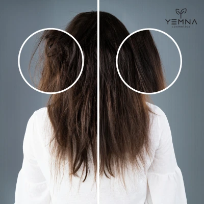 Poréznosť vlasov: prečo sú vlasy suché, krepovité a bez lesku?