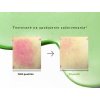 anua 10 azelaic acid serum hyaluronic acid redness 30ml.jpg