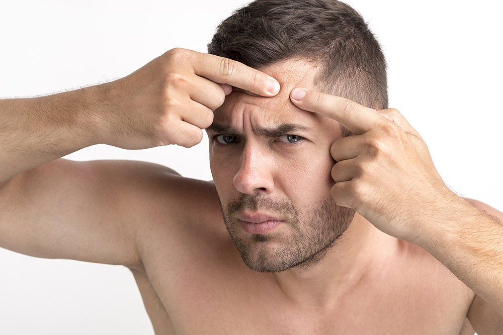 Jak se zbavit jizev po akné přírodní cestou