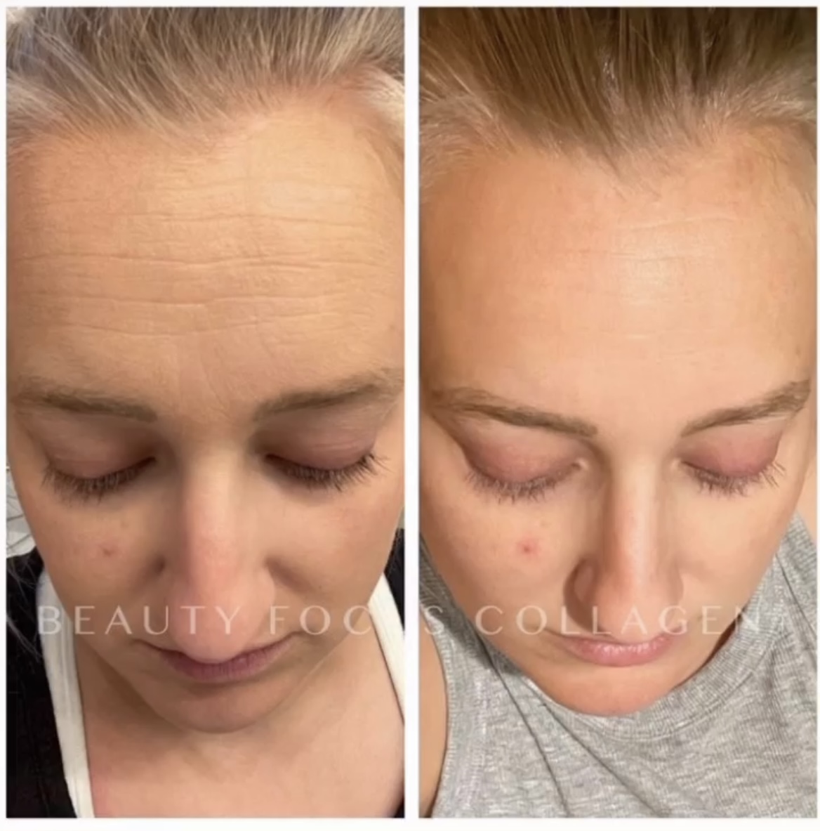 Collagen+ se stává bestsellerem