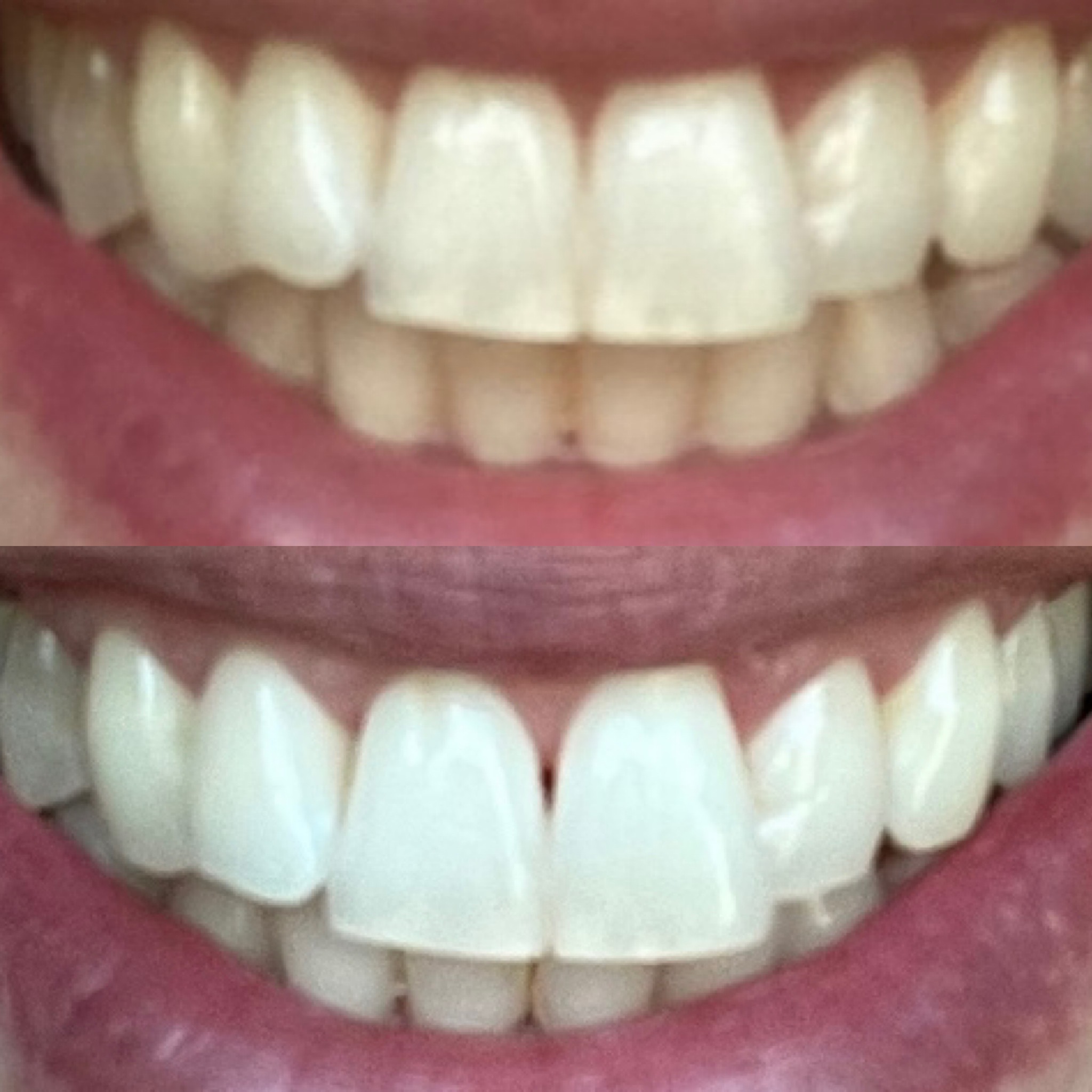 Bělící zubní pasta Nu Skin AP 24 - jedna z nejlepších