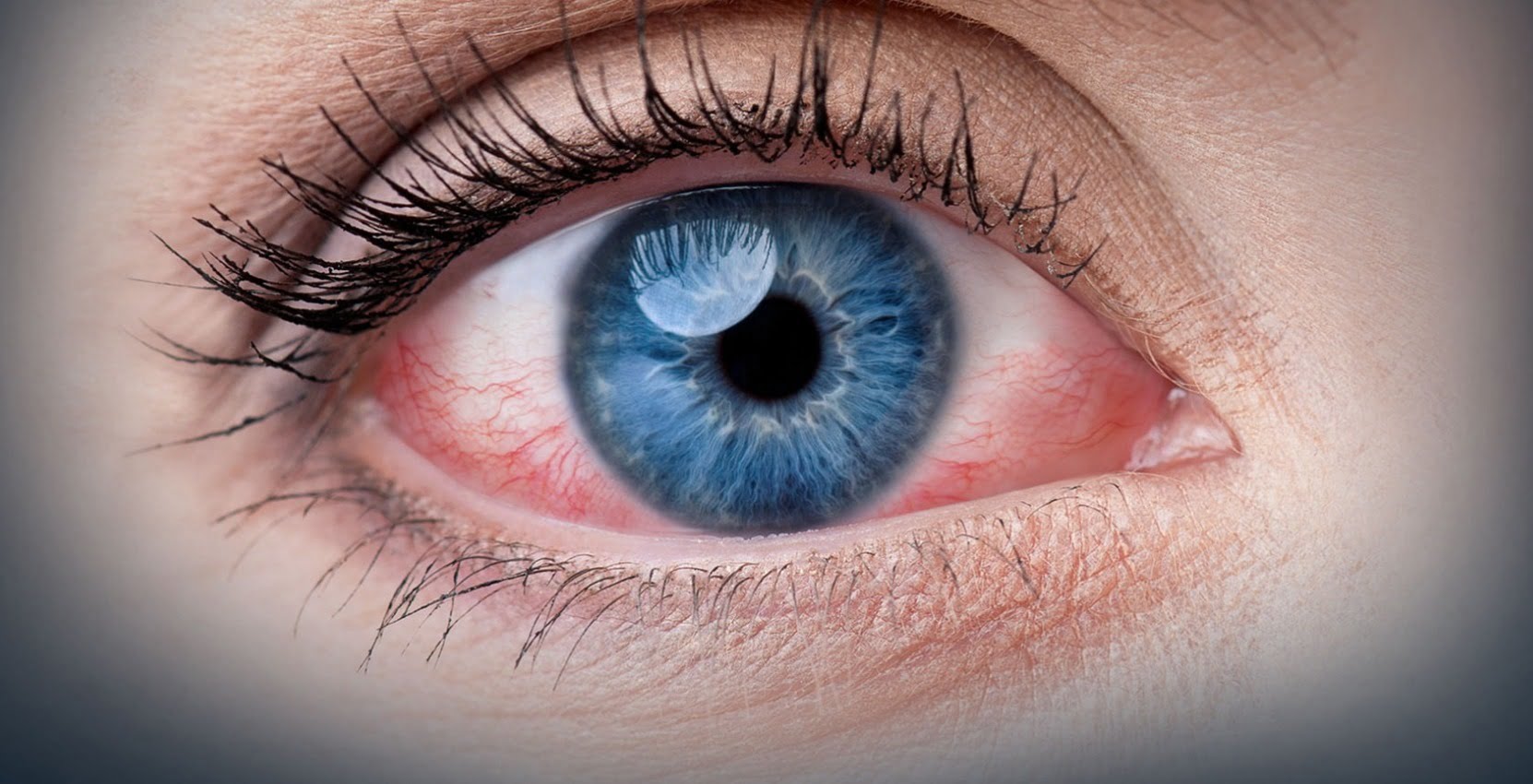 Nebezpečí hormonů v sérech na řasy: Co vědět a jak se chránit?