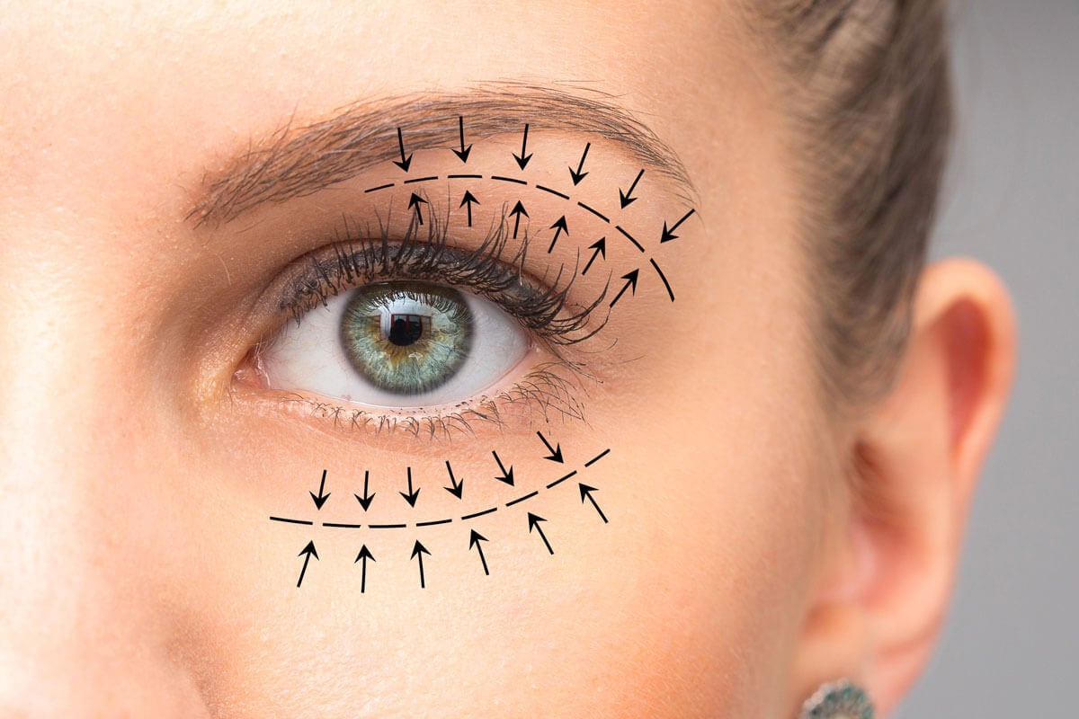 Moje zkušenost s blefaroplastikou a temporálním browliftem🎀