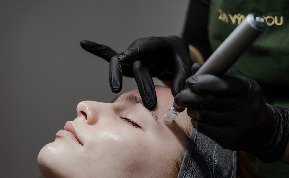 Mikrojehličkování