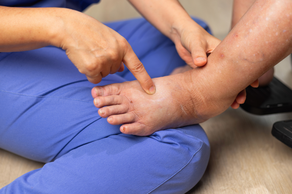 Диабетно стъпало: Как да се предпазим от усложненията на диабета