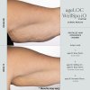 WellSpa iO before after 3min 3x arm 1