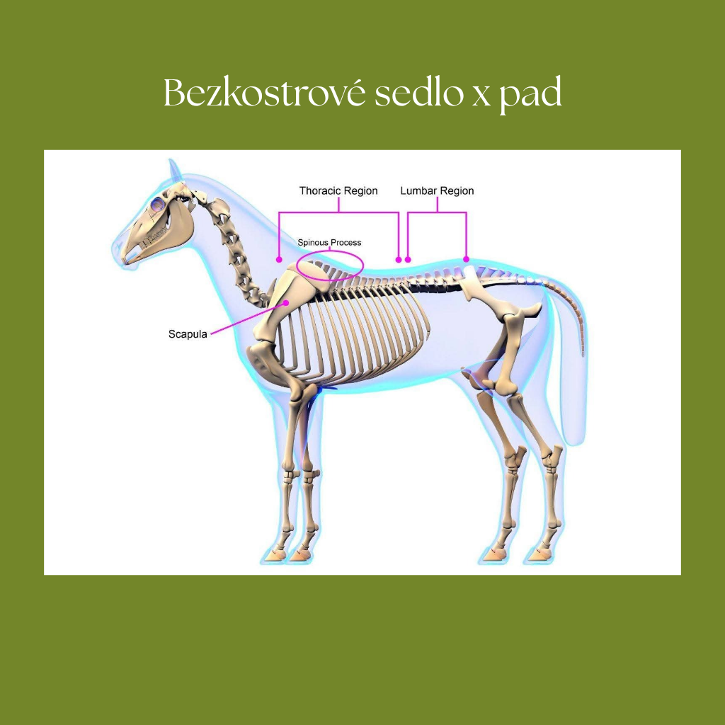 Bezkostra x pad, aneb proč na pad nepatří třmeny?
