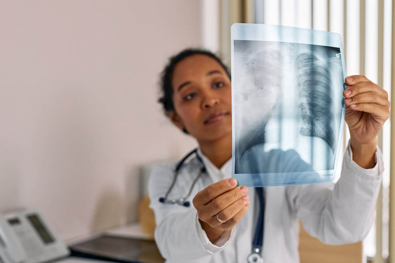 rentgen-plic-doktorka