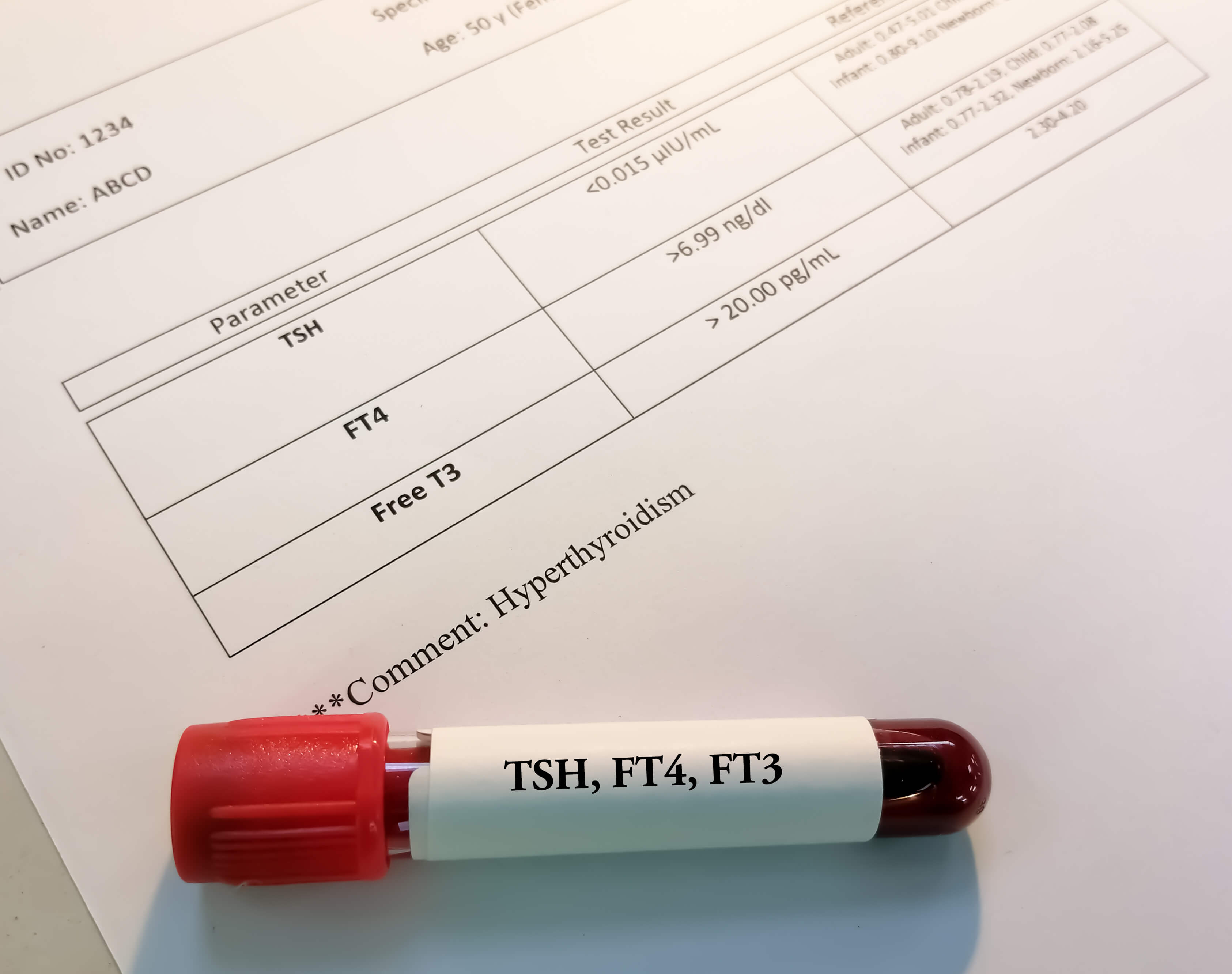 hypotyreoza-krevni-test-hodnoty