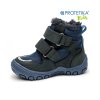protetika bagsy ortopedicke chlapcenske zimne topanky 2