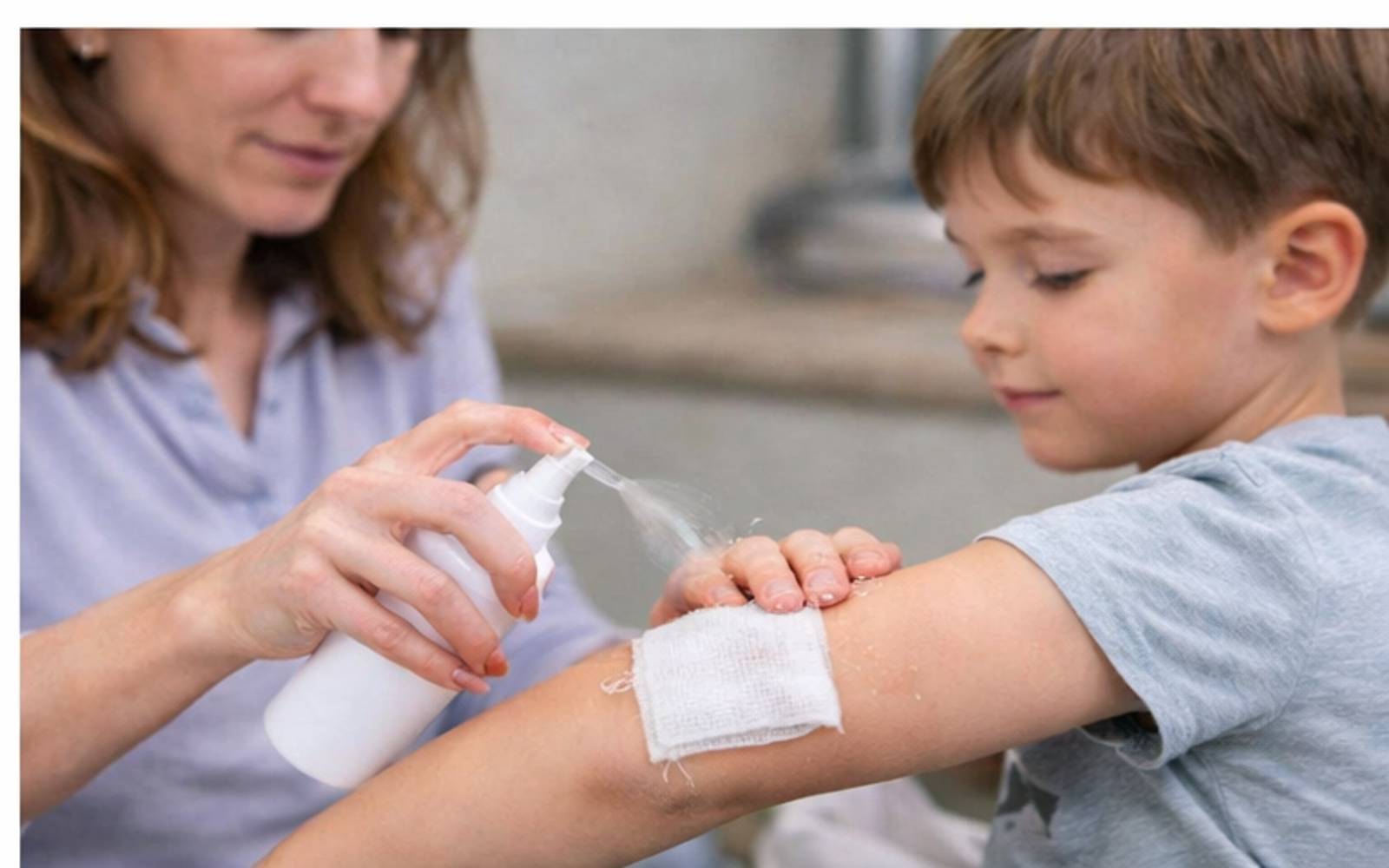 první pomoc při opaření horkou vodou – ošetření poraněné kůže