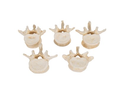 A792 03 1200 1200 Set of 5 BONElike Lumbar Vertebrae 3B Smart Anatomy