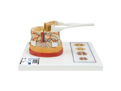 Mícha s nervovým zakončením