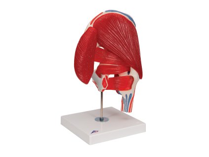 A881 Kyčelní kloub 1000177