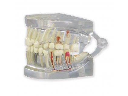 Průhledný model čelisti se zuby