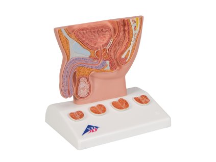 Model prostaty v poloviční velikosti