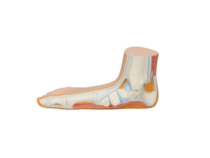 M31 05 1200 1200 Flat Foot Pes Planus Model 3B Smart Anatomy