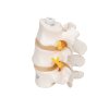 A76 8 05 1200 1200 3 Human Lumbar Vertebrae Flexibly Mounted 3B Smart Anatomy