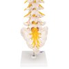 A76 5 07 1200 1200 Human Lumbar Spinal Column Model with Dorso Lateral Prolapsed Intervertebral Disc 3B Smart Anatomy